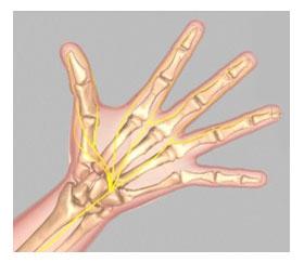 15) Median The median nerve travels through the wrist tunnel, also called carpal