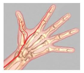 Traveling across the front of the wrist, nearest the thumb, it is this artery that is palpated when a pulse is counted at the wrist.