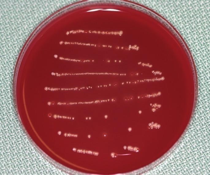 Figure 3: Case 1: Result of a chairside anaerobic culture test at the first visit showing thick bacterial lines.