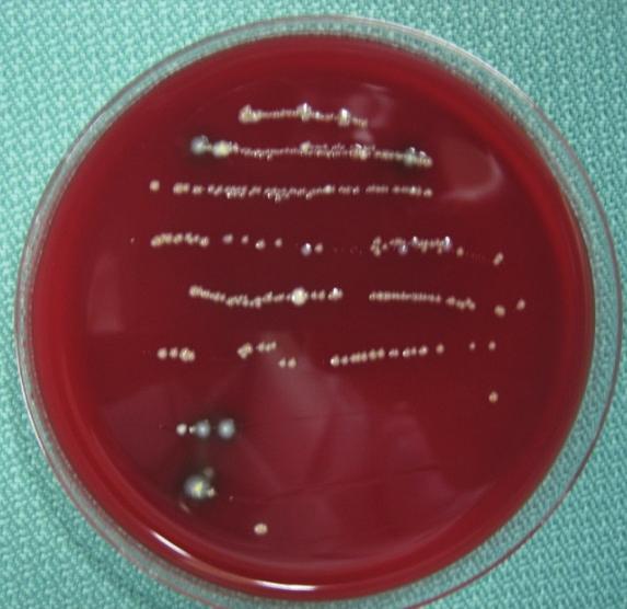 Figure 8: Case 2: Result of a chairside anaerobic culture test at the third visit showing several kinds of bacterial colonies including black-pigmented bacteria.