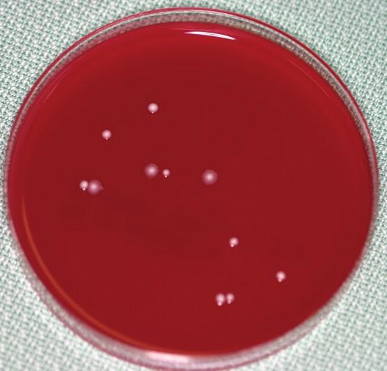 Figure 9: Case 2: Result of a chairside anaerobic culture test at the fourth visit showing scattered bacterial colonies. bacteria from root canals is beyond question.