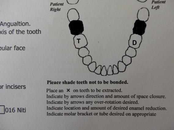 More details about teeth to be bonded/ extracted.