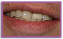 our dentists We are also a referral practice for local dentists as well and currently we use the top