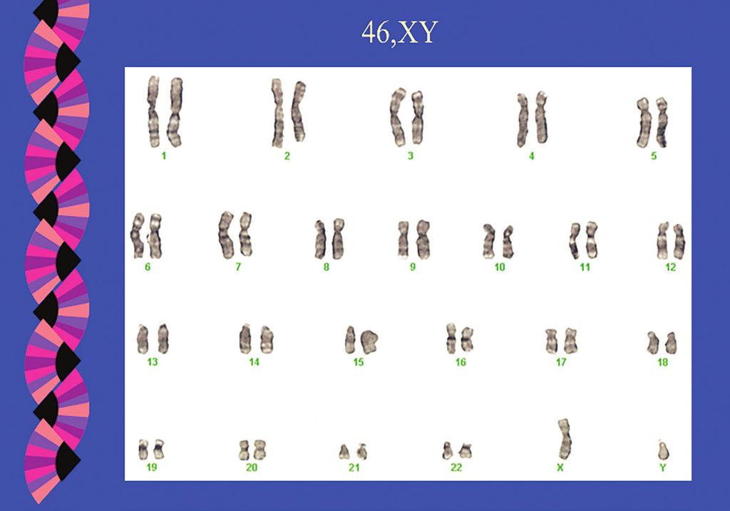 Normal human cells contain 23 pairs of chromosomes for a total of 46 chromosomes. Each pair of chromosomes is a certain size, shape and structure.