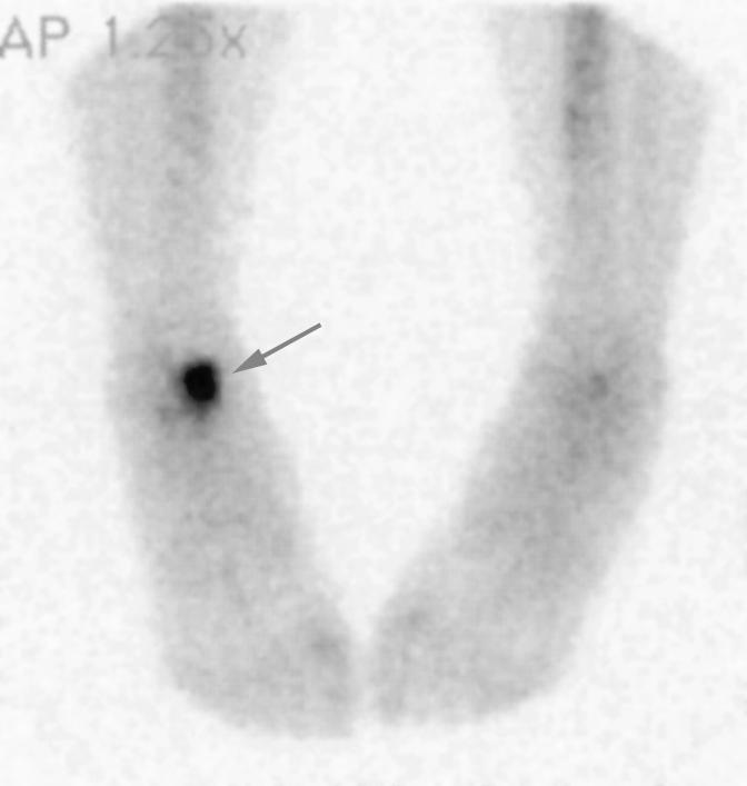 scanning, with this technique, early vascular phase, blood pool image and delayed images can be obtained (Fig. 2) [15].