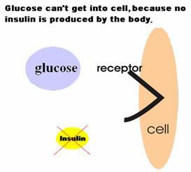 The immune system attacks the insulin producing beta cells in the pancreas Type 2 AKA Adult-Onset Diabetes The body can't respond normally to the insulin that