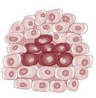 Malignant cells Normal cells Normal cells