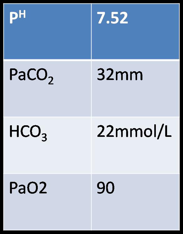 ABG analysis of Ms Salma Alkalosis PaCO2 is low HCO3 is low Respiratory Alkalosis