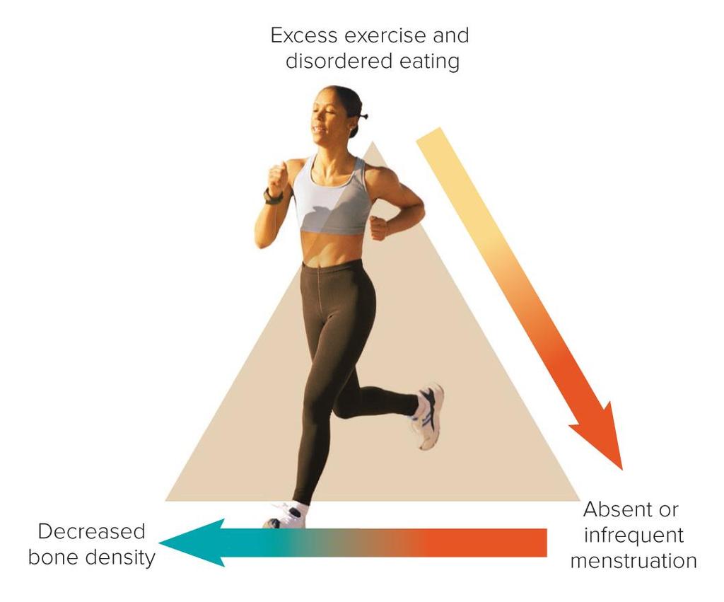 Figure 14.4 Female Athlete Triad Some girls and women striving for unrealistic thinness develop a condition called the female athlete triad.