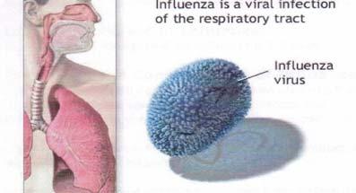 What is Seasonal Influenza?