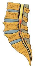 Assessment Symptoms mechanical vs non-mechanical neuropathic (spinal