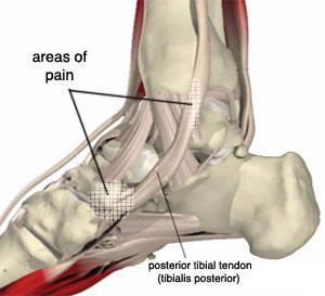 Posterior tibial