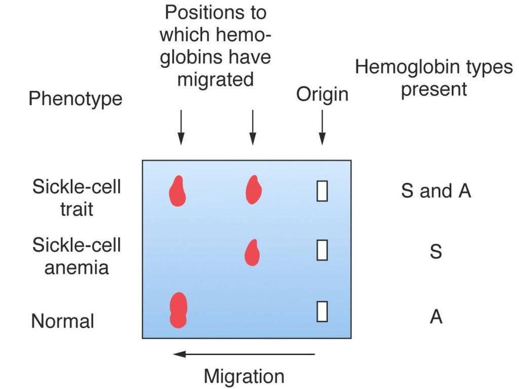 A question in an exam was about choosing which of the following hemoglobin of a sickle cell is: The third row above indicates a normal human. The second is for a patient.