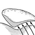 The patella a triangular shaped bone that sits in a V