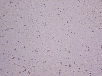 Page1492 Gram-Staining Results On treatment with the two leaf extracts, a large number of S.