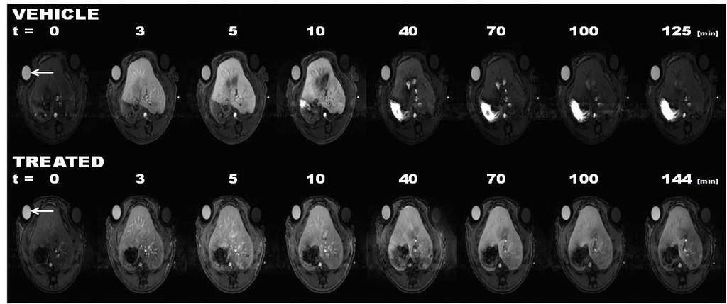 Biomarkers of Bsep inhibition in vivo: MRI imaging Ulloa et al.