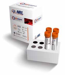 SEROLOGY MULTIMARKER RANGE QConnect Red Anti-HIV 1 IgG Anti-HCV IgG HBsAg Anti-HBc IgG Anti-HTLV I IgG Anti-Treponema IgG SR01051 Positive control 4 x 5 ml 4 x 5 ml SR01052 Negative control Positive