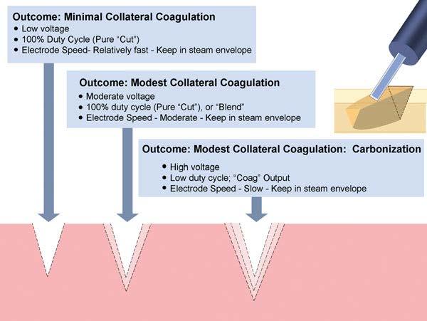 Cutting sharply confined effect, vessels not coagulated. Coagulation wider, deeper effect, vessels coagulated.