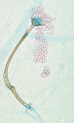 Mycoses 2014 MIC50 FTL Unpub. Data Apophysomyces 0.06-0.12 --- 0.25-1 --- 0.25-8 --- 1-4 --- Cunninghamella --- --- --- --- --- --- 0.5->16 8 Saksenaea --- --- --- --- --- --- 0.