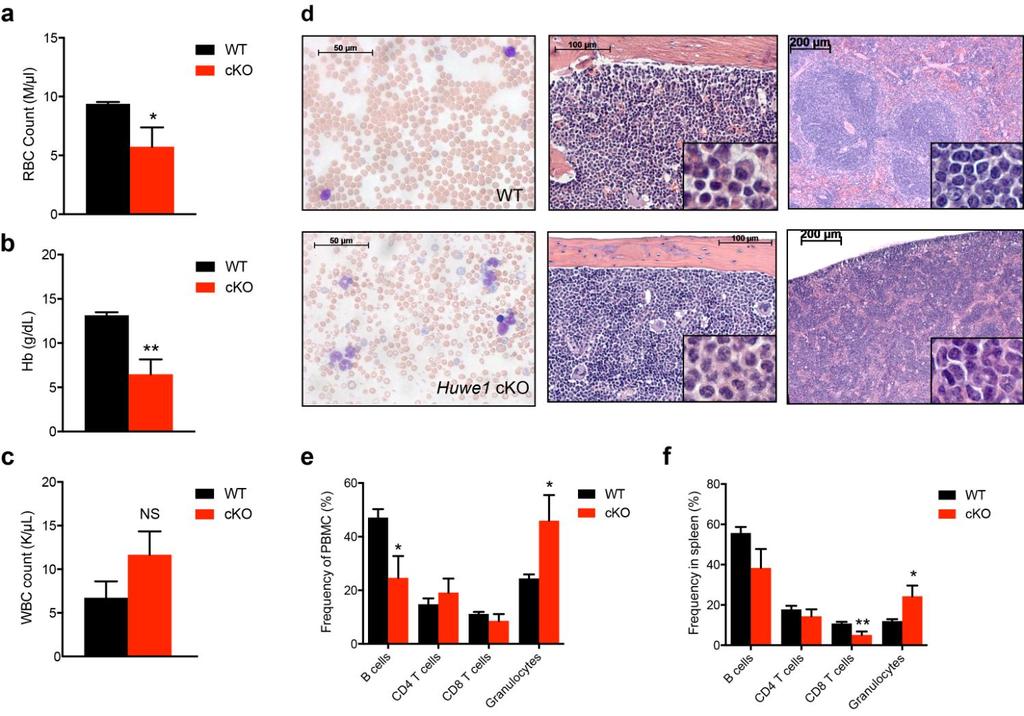 Supplementary Figure 4 Aged Huwe1 Vav1-cKO mice exhibit myeloid expansion and anemia.