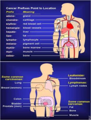 Cancer Nomenclature: Cancer prefixes point to location: Prefix Adeno Chondro Erythro Hemangio Hepato Lipo Lympho Melano Myelo Myo Osteo Meaning Gland Cartilage Red blood cells Blood vessels Liver Fat
