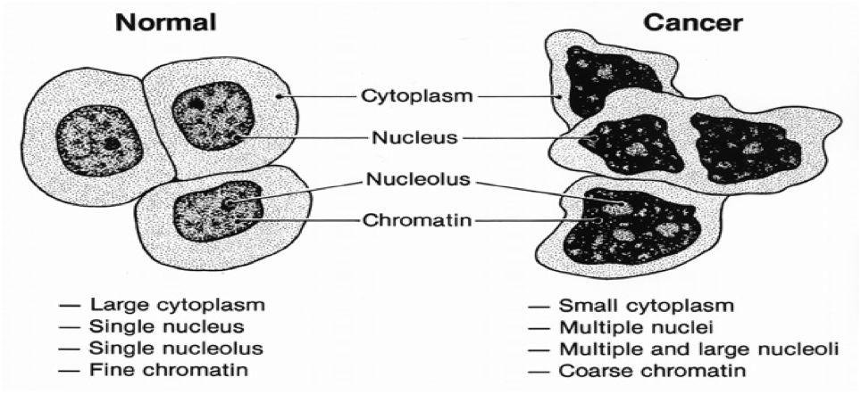 Characteristics of Malignant cell: 1 Uncontrolled growth and loss of contact phenomena are the main characteristics of malignant cells.