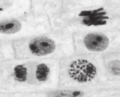 13 (b) Fig. 6.2 is a photomicrograph of root tip cells at different stages in the cell cycle. A cell in interphase is labelled. J... cell in interphase K... L... Fig. 6.2 (i) Name the stage of mitosis shown in each of cells J, K and L in Fig.