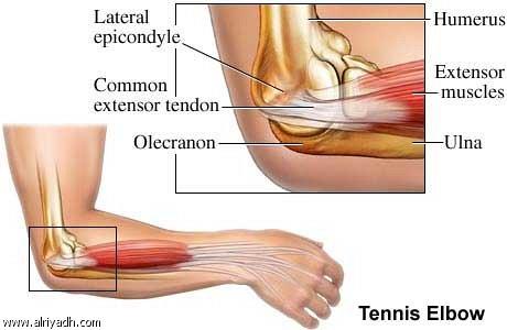 Elbow Anatomy https://www.google.