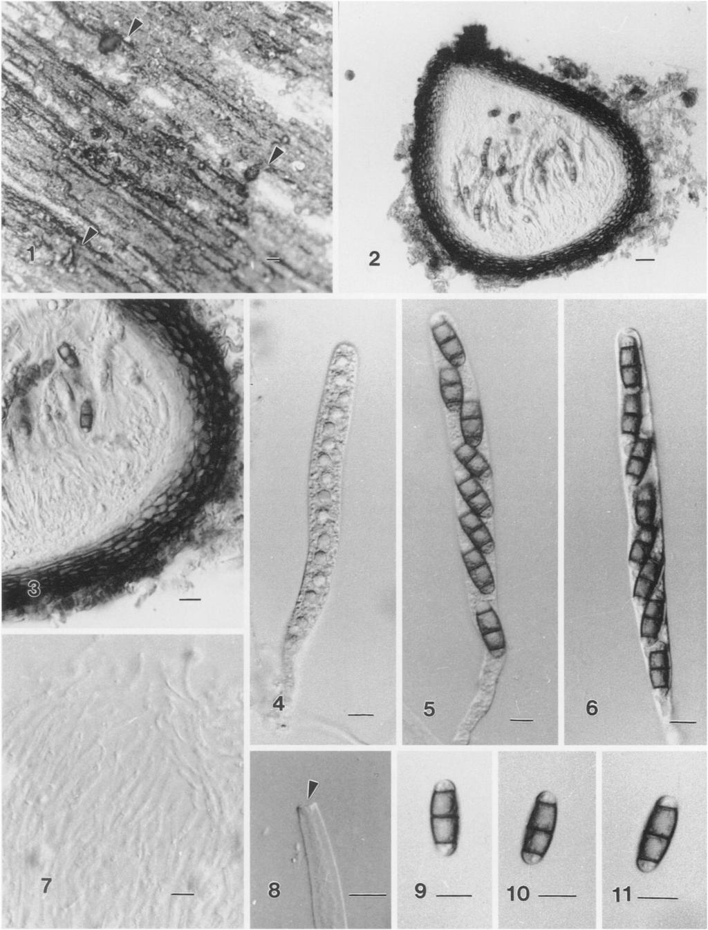 - RANGHOO AND HYDE: NEW ASCOMYCETES FROM FRESHWATER HABITATS 1057 ytyt. -1-. FIGS. 1-1 1. Ascolan'cola aquatica (from HKU (M) 5243). 1. Ascomata on wood (arrowed). 2. Section through ascoma. 3.