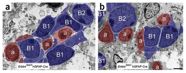 deletion to determine how these gross morphological differences were reflected at the cellular level, electron microscopic ultrastructural analyses was carried out using 1.