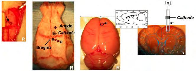 NMDA-R-Ab induce, in vivo, a state of corticomotor hyperexcitability CSF or purified IgGs are injected in prefrontal area The afferent facilitation was assessed in rats, before and after application