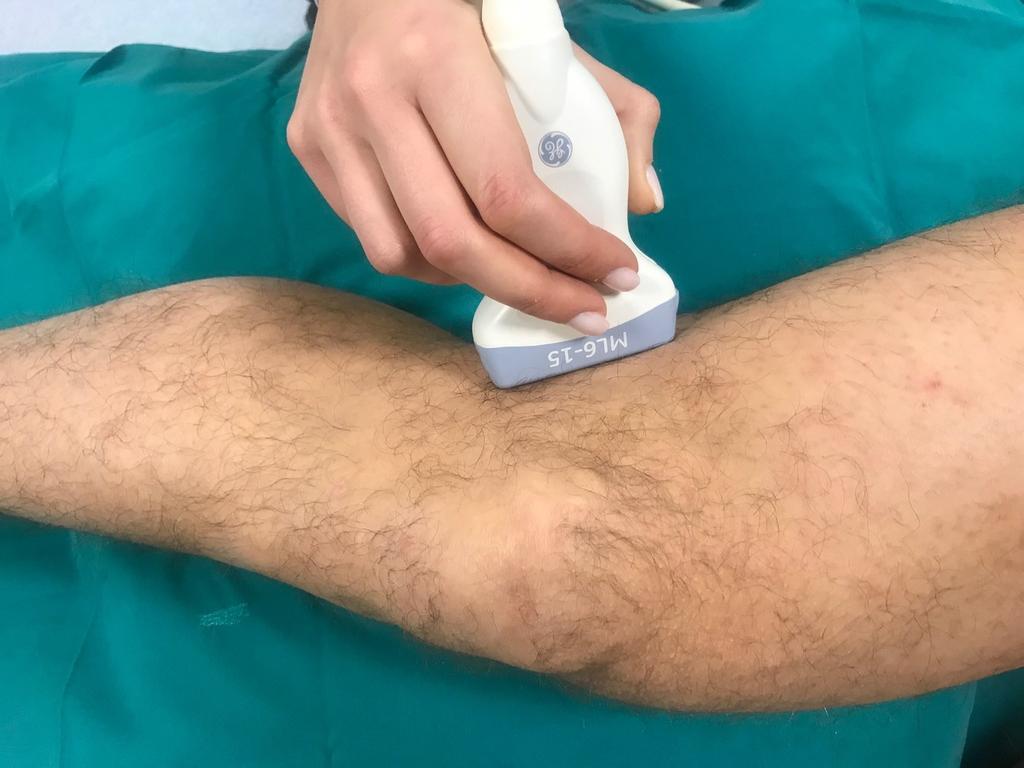 Fig. 14: Lateral knee