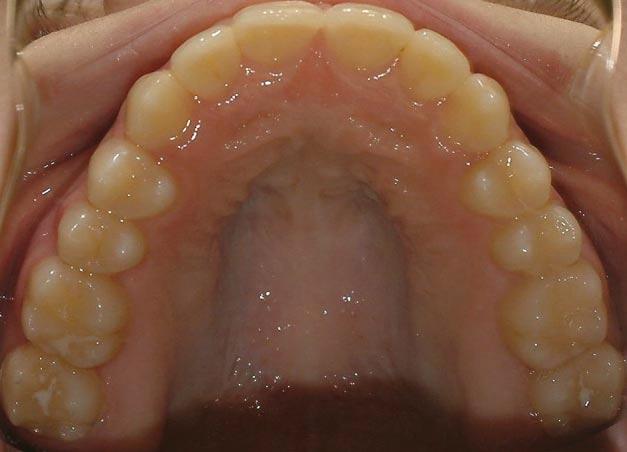 Evaluation indicated that patient could benefit from double assessment for surgical-orthodontic