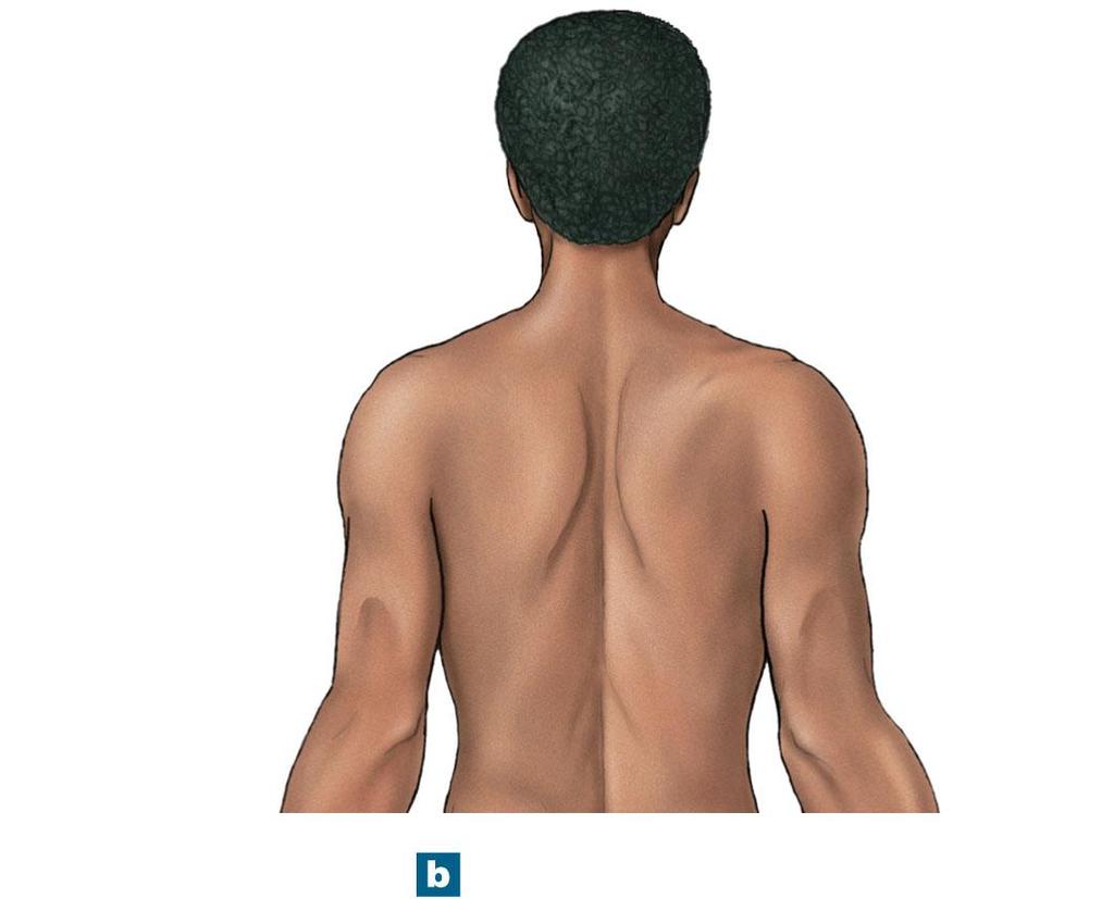 Figure 1-5b Anatomical Landmarks Cephalic or head Acromial or shoulder Dorsal