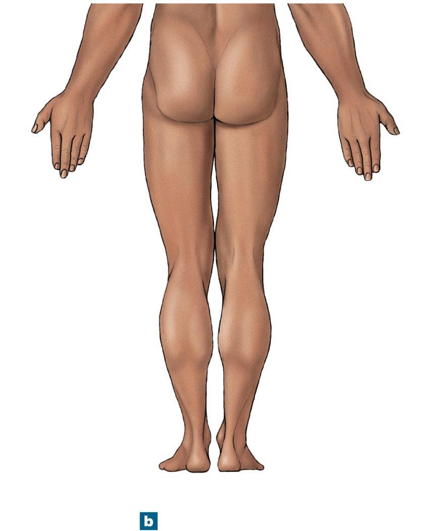 Figure 1-5b Anatomical Landmarks Lumbar or loin Upper limb Gluteal or buttock Popliteal or back