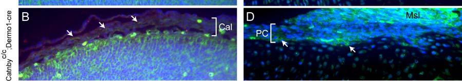 Cells still containing β-catenin after Cre-mediated recombination are indicated by arrows. Cal, calvarium; PC, perichondrium; Msl, muscle. Big yellow spots are autofluorescent blood cells.
