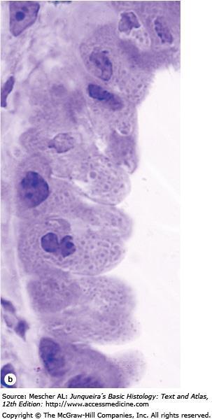 Terminal bronchiole and Clara cells (b): The nonciliated Clara cells with bulging domes of apical cytoplasm contain granules, as seen better in a plastic section. Named for Dr.