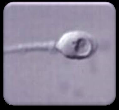 8% PVP in a glass dish 200 sperm cells per sample analyzed under
