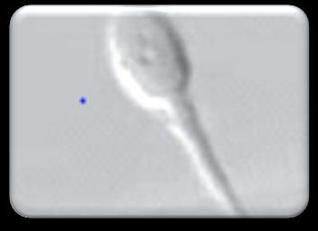 Grade I+II: normal spermatozoa parameter