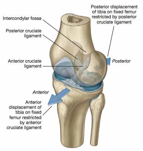 ACL Tear: Physical Examination Lachman Maneuver: - Most sensitive - Compare sides - Look for