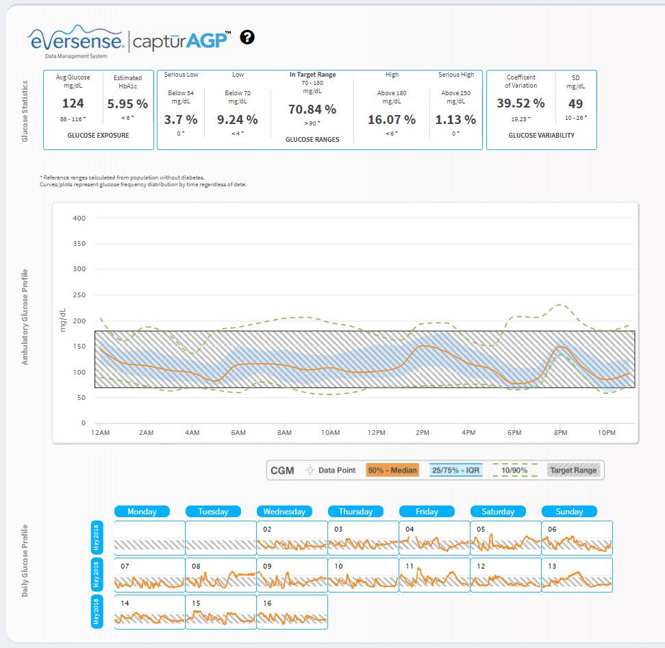 2 Eversense DMS Dashboard with AGP The Eversense DMS Dashboard is the default page that you will see each time you log into DMS.