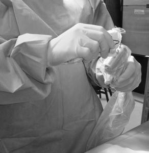 Page 11 of 13 Image 17: Prepping the ultrasound probe in a sterile fashion. Note that sterile ultrasound gel is applied to the outside of the sterile transducer sheath.