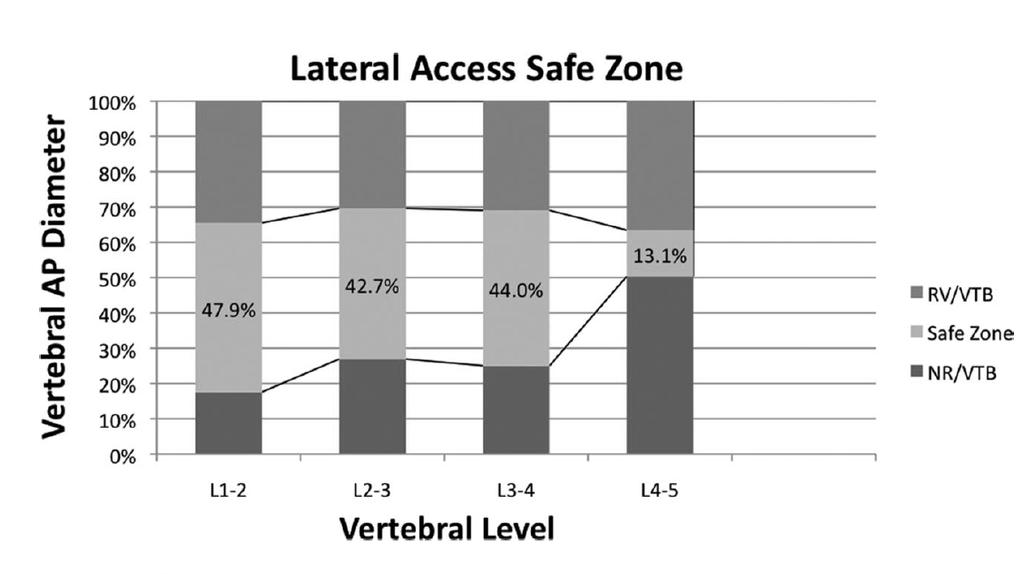Working Zone Regev (, 2009) 100 lumbar MRIs from spine pts studied safe