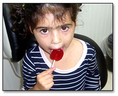 The lollipop with the attached film is returned to the child, who is told to lick the lollipop again.