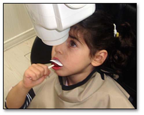 The child has now associated the radiograph procedure with a pleasurable experience (the licking of the lollipop) and has been desensitized to the extent the more difficult posterior radiographs can
