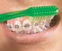 Keeping Your Mouth Healthy Taking care of your teeth and braces helps keep your mouth healthy and your braces working. Regular brushing and flossing are very important.