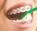 Get into the habit of flossing every day. It helps remove all the plaque and bits of food between your teeth that your toothbrush misses. It also helps keep your gums healthy.