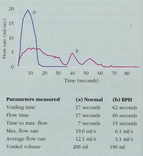 the maximum flow rate in a patient