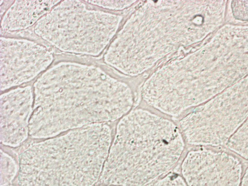 differentiated myeloid cells contribute