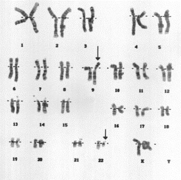 Induce random chromosomal aberrations Analyze karyotype of all cells
